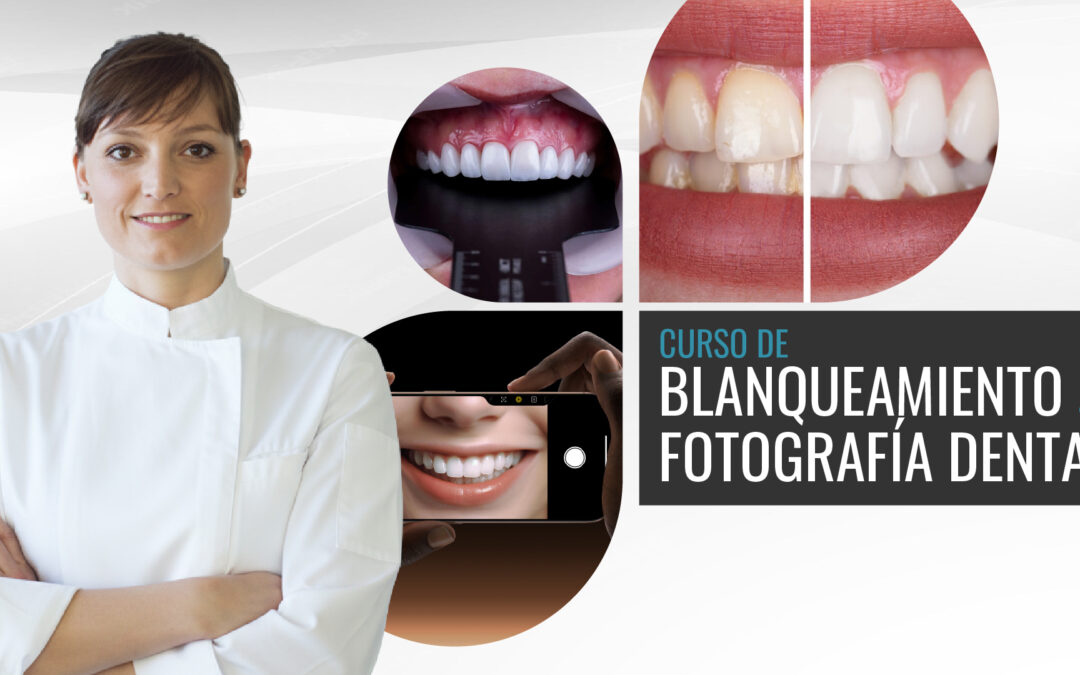 Curso de Blanqueamiento y Fotografía dental con teléfono Móvil